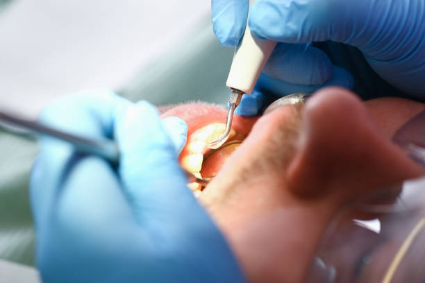Best Dental Abscess Treatment in Lannon, WI